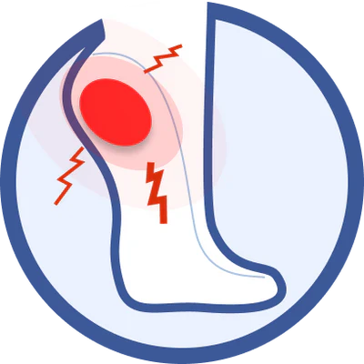 Plantar Fasciitis