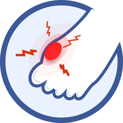 Bunions/Hallux Valgus